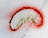 Caloplaca tiroliensis image