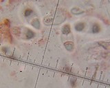 Caloplaca tiroliensis image