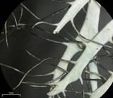 Heterodermia lutescens image