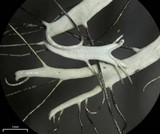 Heterodermia lutescens image