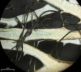 Heterodermia lutescens image