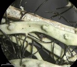 Heterodermia verrucifera image