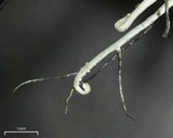 Heterodermia circinalis image