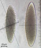 Pertusaria macounii image