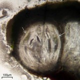 Pertusaria macounii image