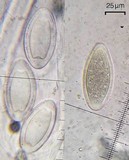 Pertusaria paratuberculifera image