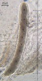 Pertusaria paratuberculifera image