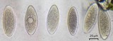 Pertusaria paratuberculifera image