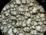 Pertusaria multipunctoides image