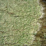Pertusaria amara f. amara image