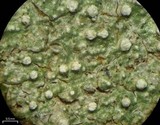 Pertusaria amara f. amara image