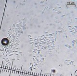 Alyxoria varia image