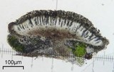 Amandinea milliaria image