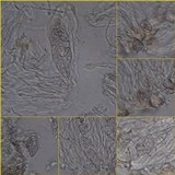 Blennothallia crispa image