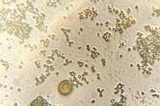 Fuligo septica image