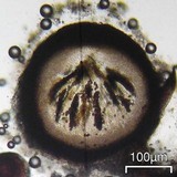 Muellerella ventosicola image