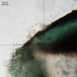 Lecidea atrobrunnea image