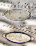 Thecotheus holmskioldii image