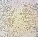Nectria peziza image