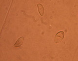 Tylopilus atronicotianus image