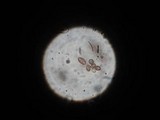 Psilocybe semilanceata image