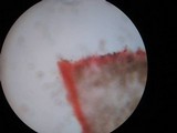 Hypholoma ericaeum image