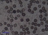 Scleroderma polyrhizum image