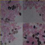 Panaeolus papilionaceus var. capitatocystis image