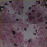 Panaeolus papilionaceus var. capitatocystis image