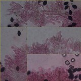 Panaeolus papilionaceus var. capitatocystis image
