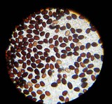 Coprinellus impatiens image