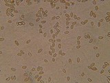 Inocybe obscurobadia image