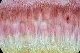Caloplaca nivalis image