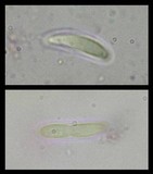 Caloplaca nivalis image