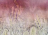 Caloplaca nivalis image