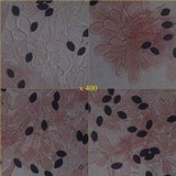 Panaeolus papilionaceus var. capitatocystis image