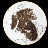 Ophiocordyceps gracilioides image