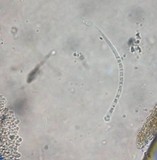 Ophiocordyceps gracilioides image