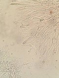 Ascocoryne sarcoides image