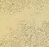 Ascocoryne sarcoides image