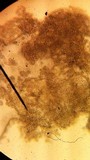 Lycoperdon marginatum image