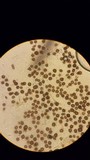 Scleroderma bovista image