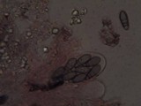 Arthonia elegans image