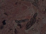 Arthonia elegans image