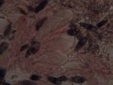 Arthonia elegans image