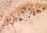 Agaricus bisporus image
