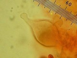 Leucoagaricus erythrophaeus image