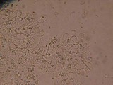 Echinoderma echinaceum image