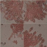 Amanita sect. Vaginatae image