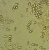 Lepiota atrodisca image